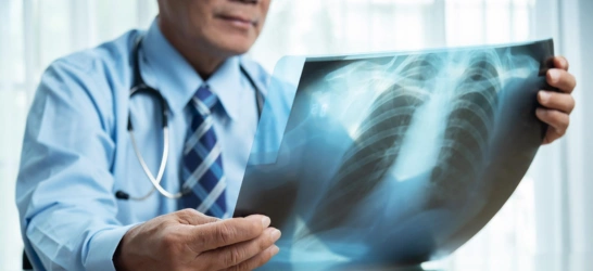 Digital X-Ray