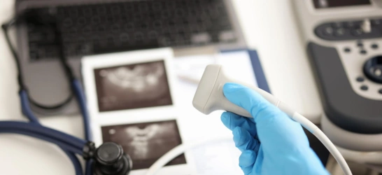 Ultrasound Scan
